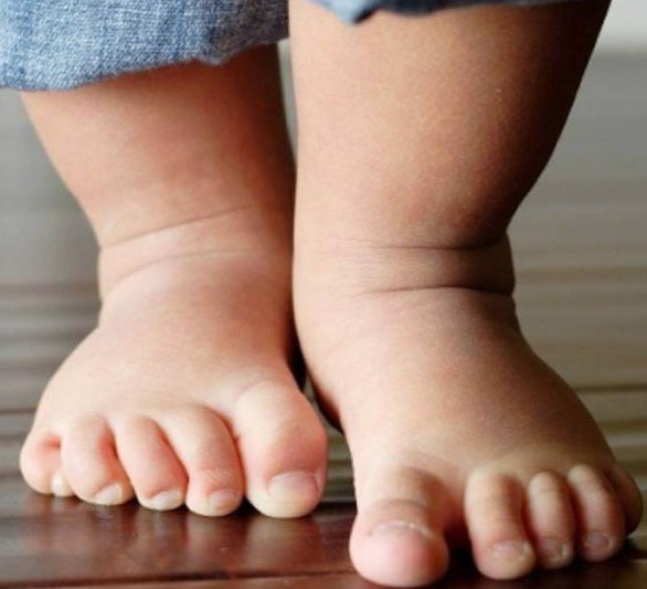 Войта-терапия для детей в Челябинске